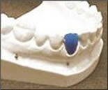 blue_tooth.jpg